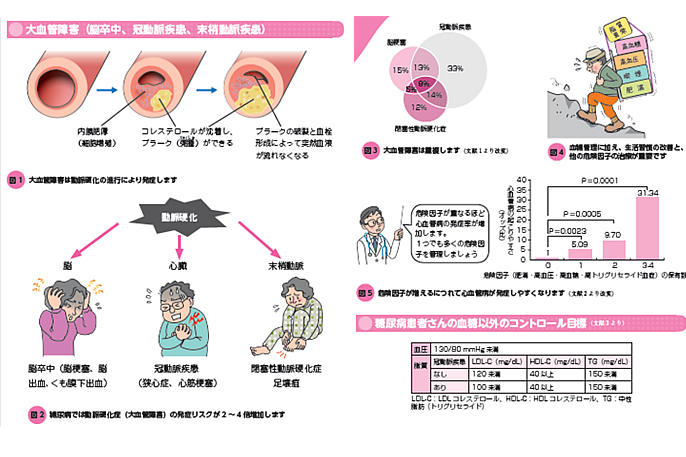 大血管障害